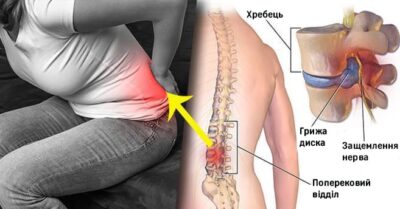 Крижі в остеопатії
